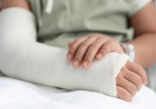 Workers Compensation Attorneys in Carrollton Georgia SWS Law Firm - Image of a persons arm in a cast